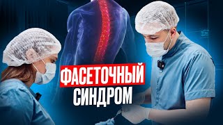 ФАСЕТОЧНЫЙ СИНДРОМ || Что такое фасетки, симптомы фасет. синдрома, диагностика, лечение