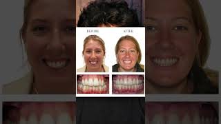 This one adjustment can change your entire look.Do this consistently and the difference shows #facts