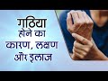 ARTHRITIS Symptoms Treatment Sachin Kaushik गठ य लक षण और इल ज Aarogya ARTHRITIS Symptoms Treatment Sachin Kaushik गठ य लक षण और इल ज Aarogya