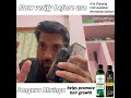Result of songara bhringa ayurvedic hair oil and herbal shampoo amazing results