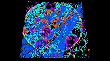 Segmentation with Dragonfly 2022.2