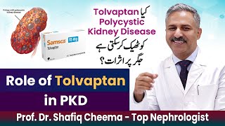 Role Of Tolvaptan Or Samka In Pkd Or Polycystic Kidney Disease