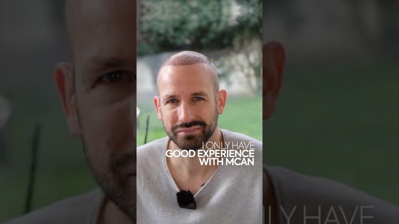 Hair Transplant Turkey | Dominik’s hair journey with MCAN 