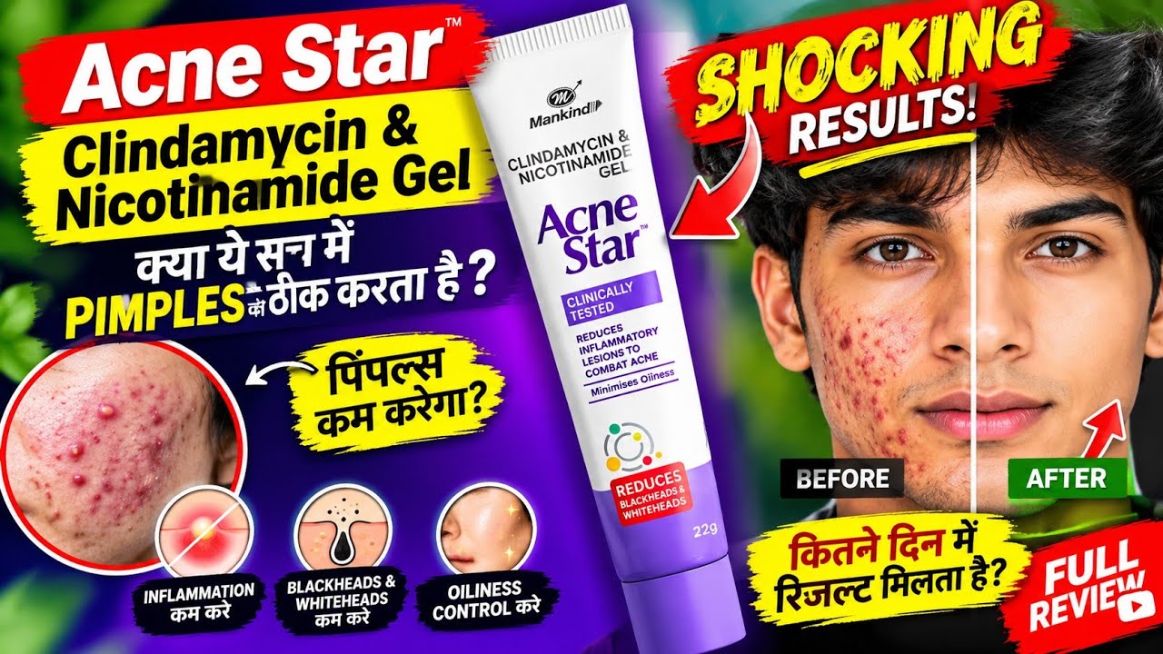 acnestar gel का उपयोग कैसे करें ?पूरी जानकारी के साथ हिंदी में how to ...