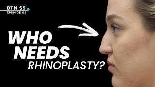 Who Really Needs a Rhinoplasty? | BTM5 Ep.4