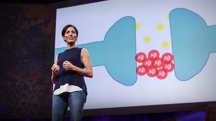 What You Can Do to Prevent Alzheimer's | Lisa Geno...