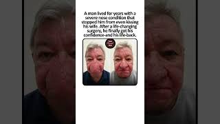 He Couldn’t Even Kiss His Wife… Until This Life-Changing Surgery  #lifechanging