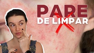 3 dicas de como cuidar de uma pele EM CRISE seja rosácea ou pele sensibilizada | Dica de Esteticista