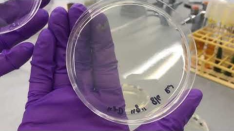 Ubiquity of microorganisms