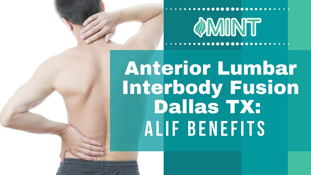Anterior Lumbar Interbody Fusion Dallas TX: ALIF Benefits