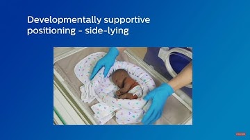 Developmentally supportive infant positioning - side-lying