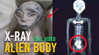 Mexico Alien X-Ray - Full Video (historic broadcast - scientific analysis)