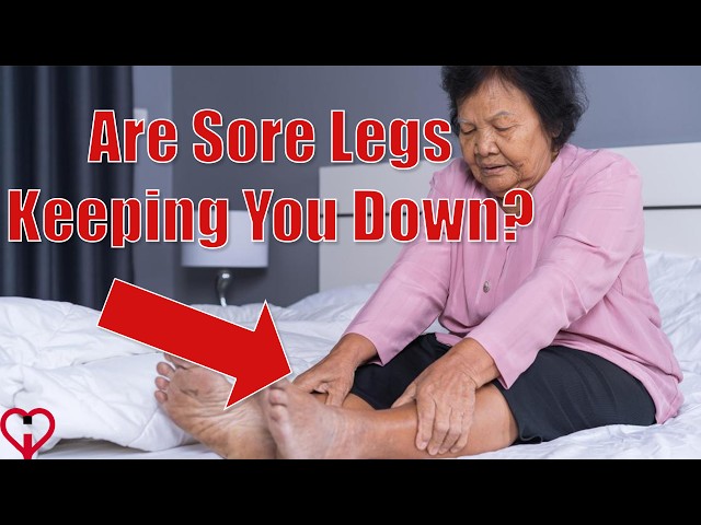 Get Up and Fix Your Legs Today!