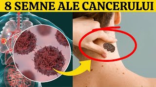 8 SEMNE TIMPURII ALE CANCERULUI