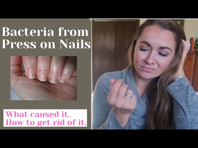 Can fake nails cause mold? - Quora