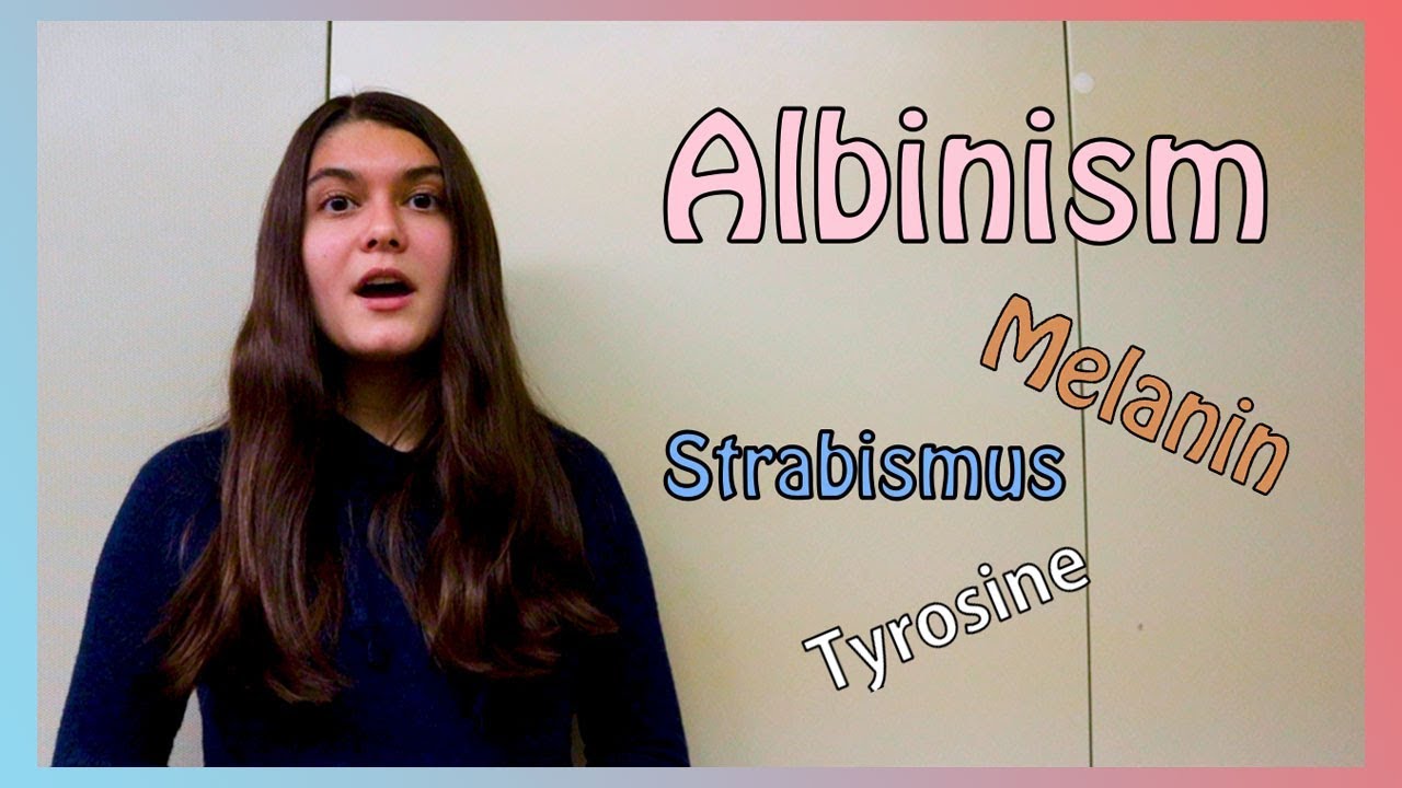 The Truth About Albinism