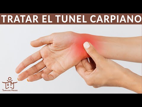 4 PUNTOS de MEDICINA CHINA para el TRATAMIENTO del TUNEL CARPIANO
