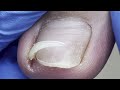 Pedicure Tutorial: The Complete Manicure Process!
