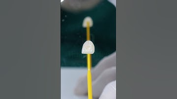 ✨ Hoàn thiện nụ cười rạng rỡ cùng dịch vụ dán sứ veneer #dentist #rangsuthammy #veneers #shorts