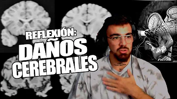 ¿Qué es el cerebro de boxeador?