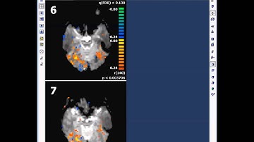 BrainVoyager Tutorial - Analysis in Original Space - Part 3
