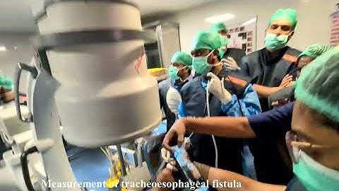 Malignant Tracheoesophageal fistula - Straight SEMS placement