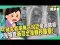 40歲女「氣喘無法說話」慘得肺癌！X光檢查「肺部全是轉移腫瘤」嚇壞醫師！？【 @57healthy 】#江坤俊 醫師