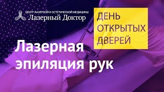 Лазерная эпиляция рук - трансляция Periscope(Подробнее о процедуре лазерной эпиляции рук: ..., 2016-02-08T08:03:39.000Z)