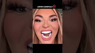 @DTHshow on youtube, Bad Veneers Are Always Obvious 😬 #oralhealth #veneers #shorts