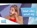 خلطات طبيعية لإزالة التجاعيد تحت العينين وتخفيف الانتفاخات