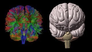 Diffusion Tensor Imaging (DTI)