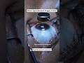 Wondering How PRK Actually Removes Your Specs Number?