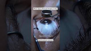 Wondering How PRK Actually Removes Your Specs Number?