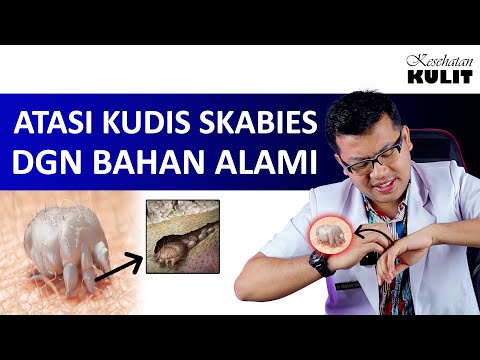 Video: 3 Cara Menyembuhkan Kudis