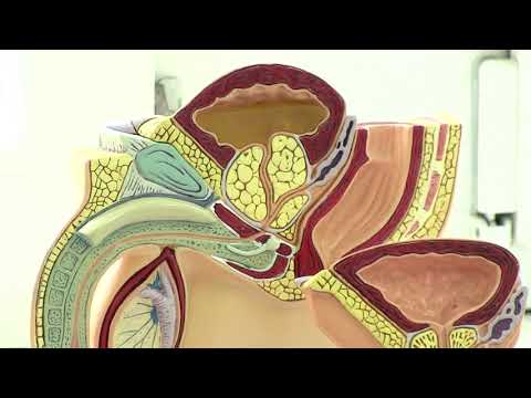 Video: Priešlaikinė Ejakuliacija: Simptomai, Priežastys, Gydymas