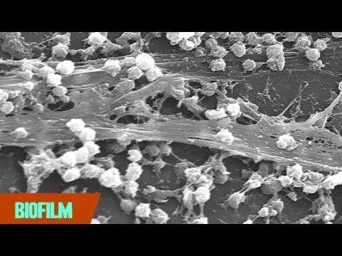 Biofilm: A New (Gross) Thing to Worry About