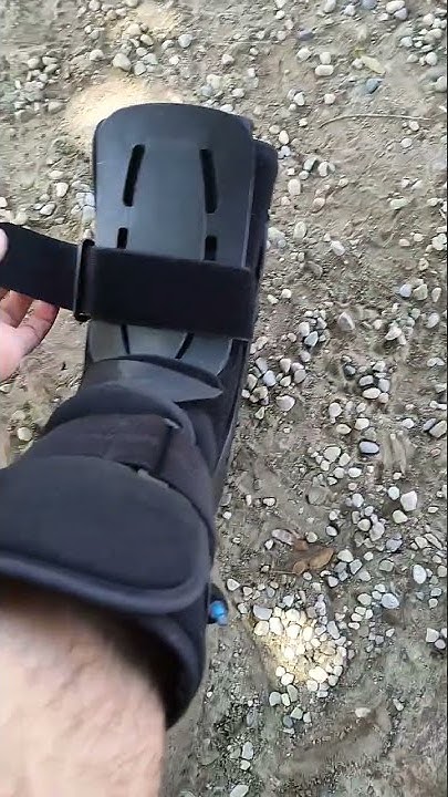 my-worst-injury-ever-bad-ankle-sprain-youtube