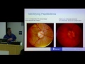 CSF presents "Idiopathic Intracranial Hypertension (IIH): Advances in Treatment" - Dr. Imran Chaudry