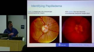 CSF presents 'Idiopathic Intracranial Hypertension (IIH): Advances in Treatment'  Dr. Imran Chaudry