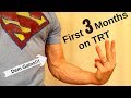 First 3 Months on TRT - Testosterone Replacement Therapy