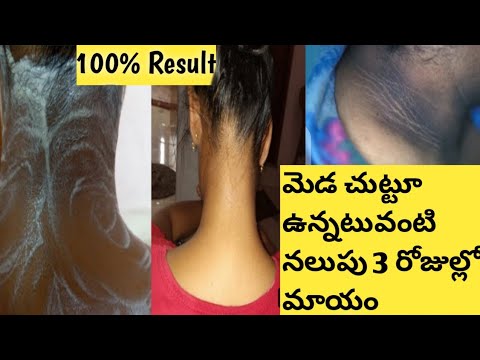 How to Get Rid of Dark neck || Remove Dark Neck in Telugu ||BLACK NECK - YouTube