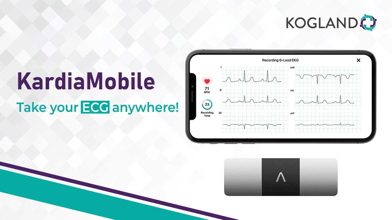 IronRod Health - How To: Record Your EKG Using the KardiaMobile 6L in the  Omron App 