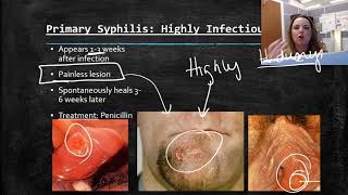 Treponema pallidum   Syphilis