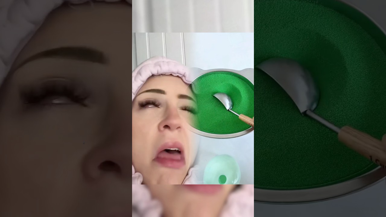 Малышу нарастили ресницы…