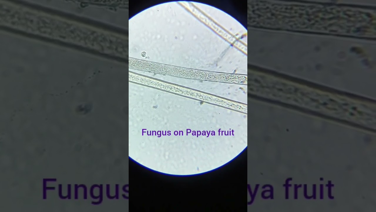 Fungus viewed under miscroscope ESAW SM 02 