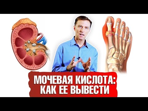 Как определить мочевую кислоту в домашних условиях