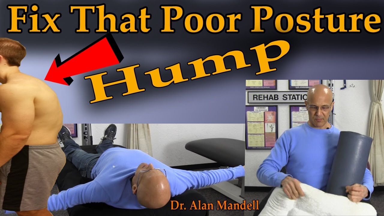 Fix That Poor Posture Hump - Dr Mandell - YouTube