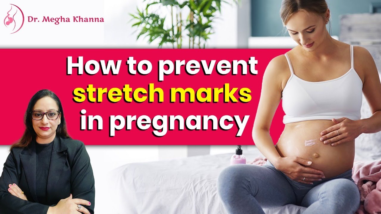 How to Prevent Stretch Marks During Pregnancy | Causes, Diet Tips & Treatment Options