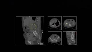 CT of Urinary Pathology 2 | Free Radiology CME