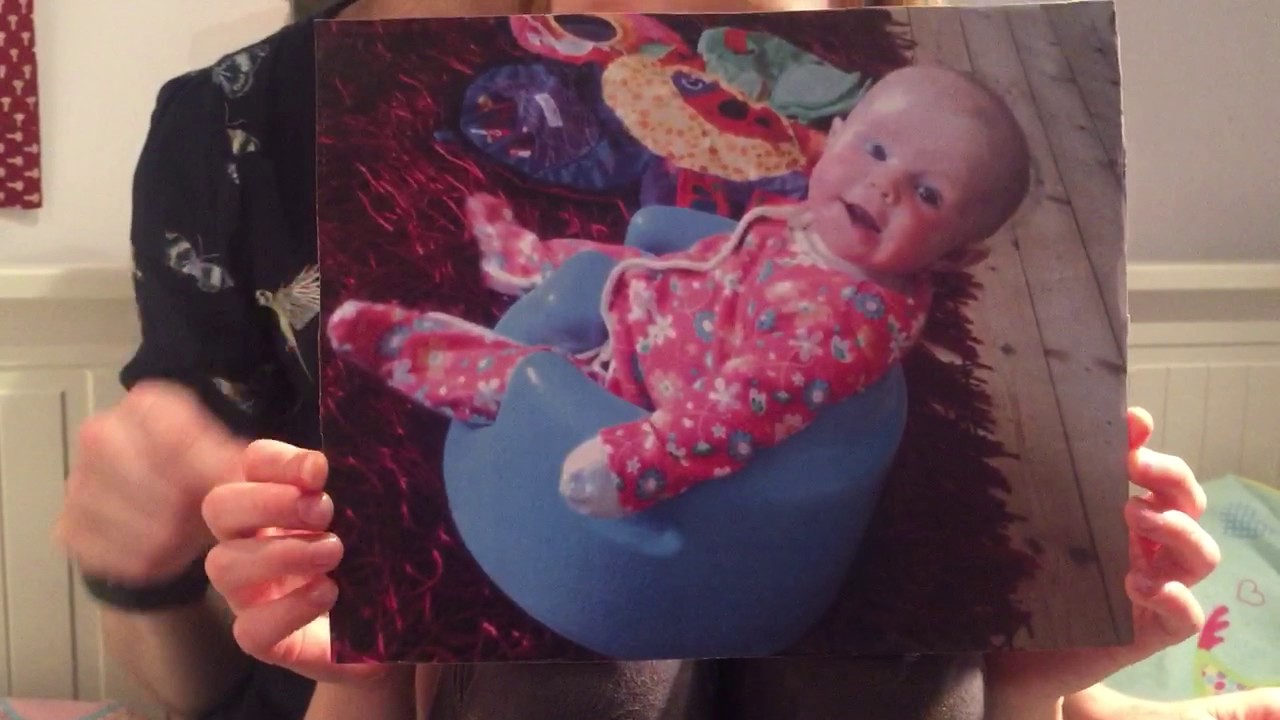 The Aron Regimen is for mild to moderate cases of eczema too 